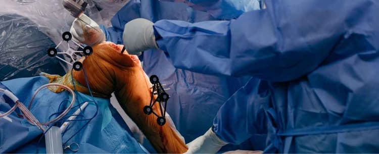 Robotic Assisted vs. Conventional Total Knee Replacement: Which Is Right for You?